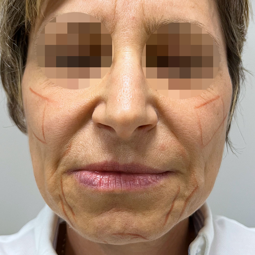 Dottoressa Giorgia Marelli Medicina Estetica