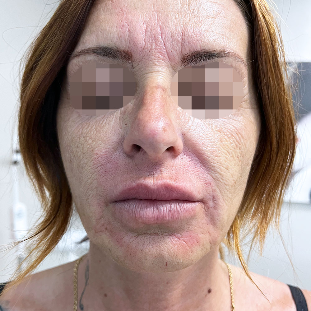 Dottoressa Giorgia Marelli Medicina Estetica