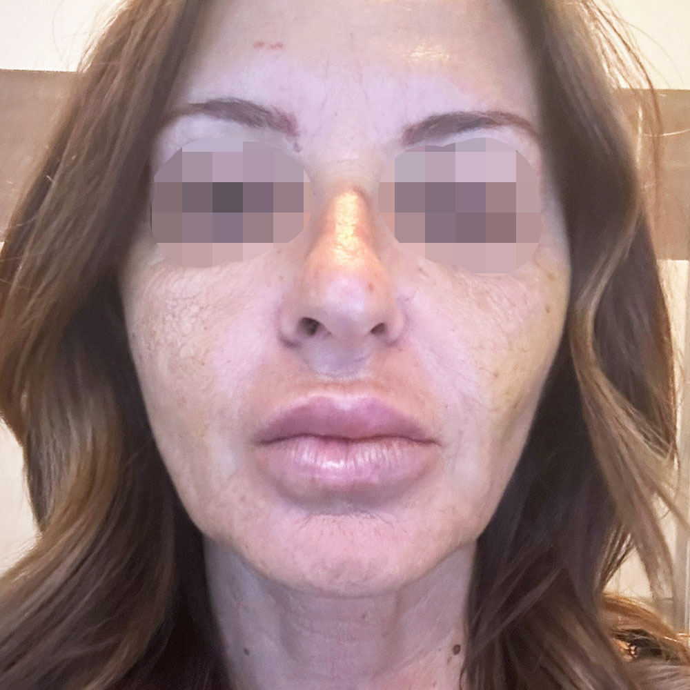 Dottoressa Giorgia Marelli Medicina Estetica