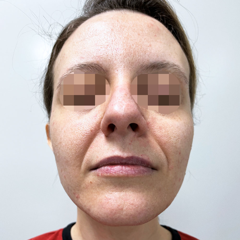 Dottoressa Giorgia Marelli Medicina Estetica