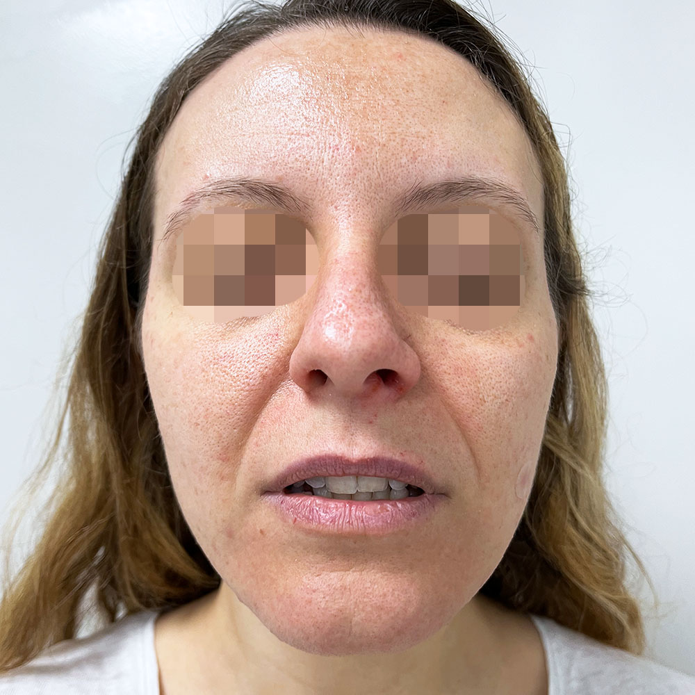 Dottoressa Giorgia Marelli Medicina Estetica