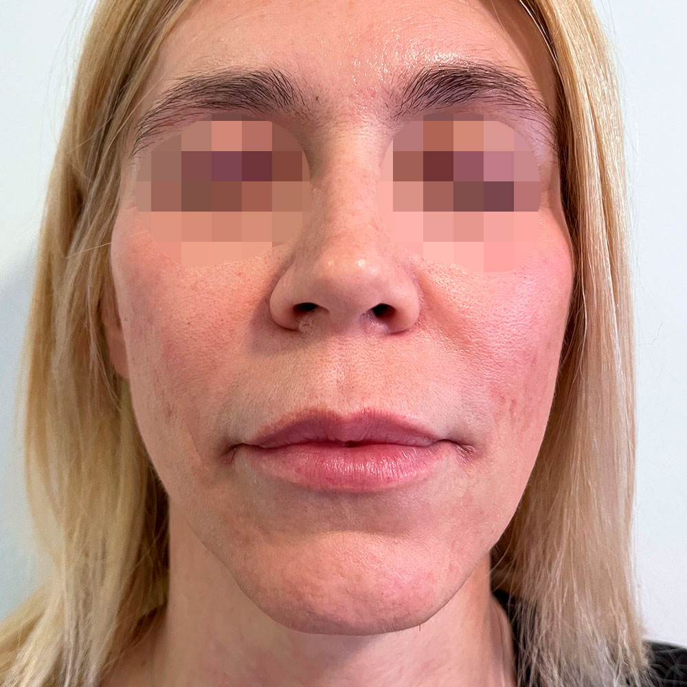 Dottoressa Giorgia Marelli Medicina Estetica